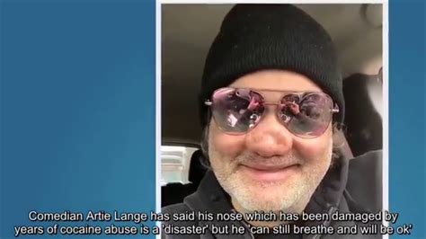 artie lange nose|Comedian Artie Lange says his collapsed nose convinced him to。